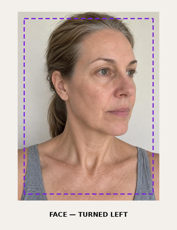 Face, turned left