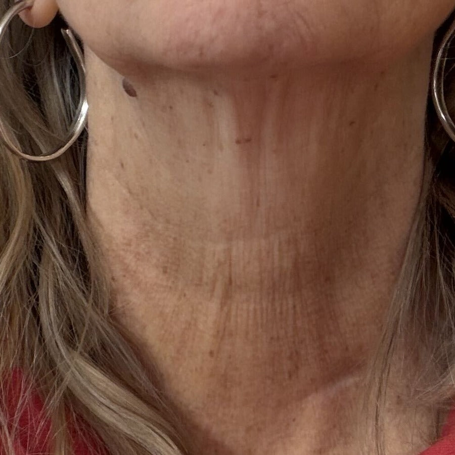 NECK before