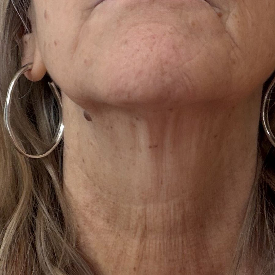 NECK before
