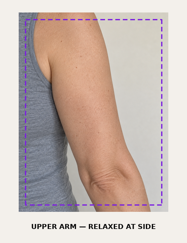 If your area is upper arms