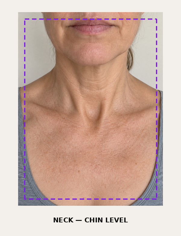 Neck