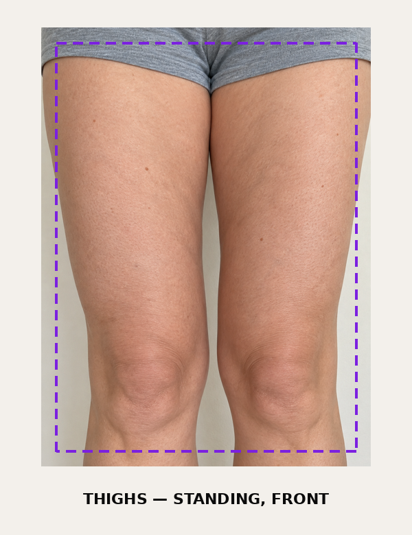 If your area is thighs