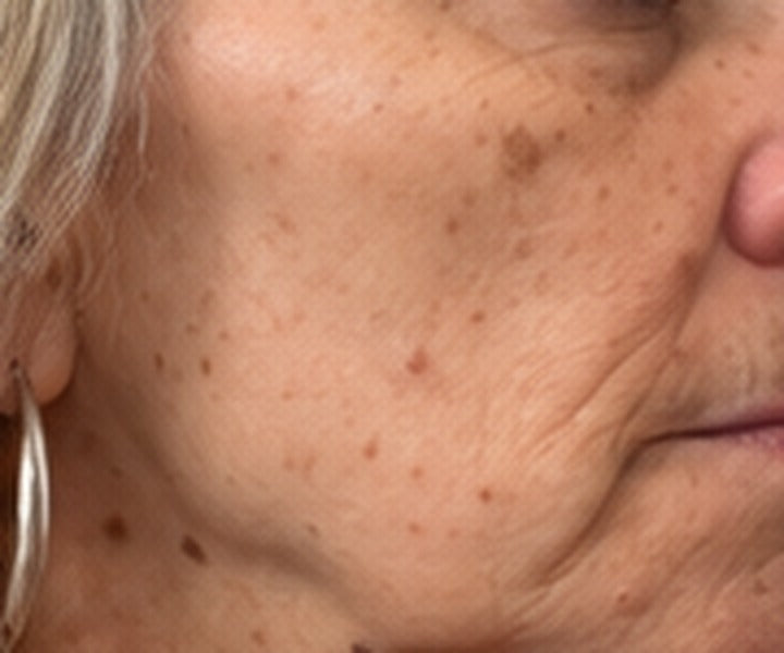 CHEEK after